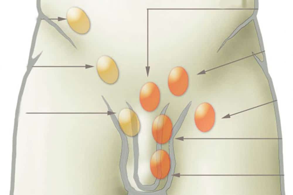 prostatita ereditară próstata y disfunción eréctil